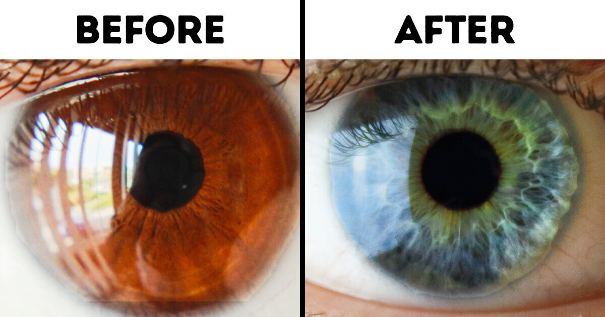 7 Things That Can Change Your Eye Color Bright Side