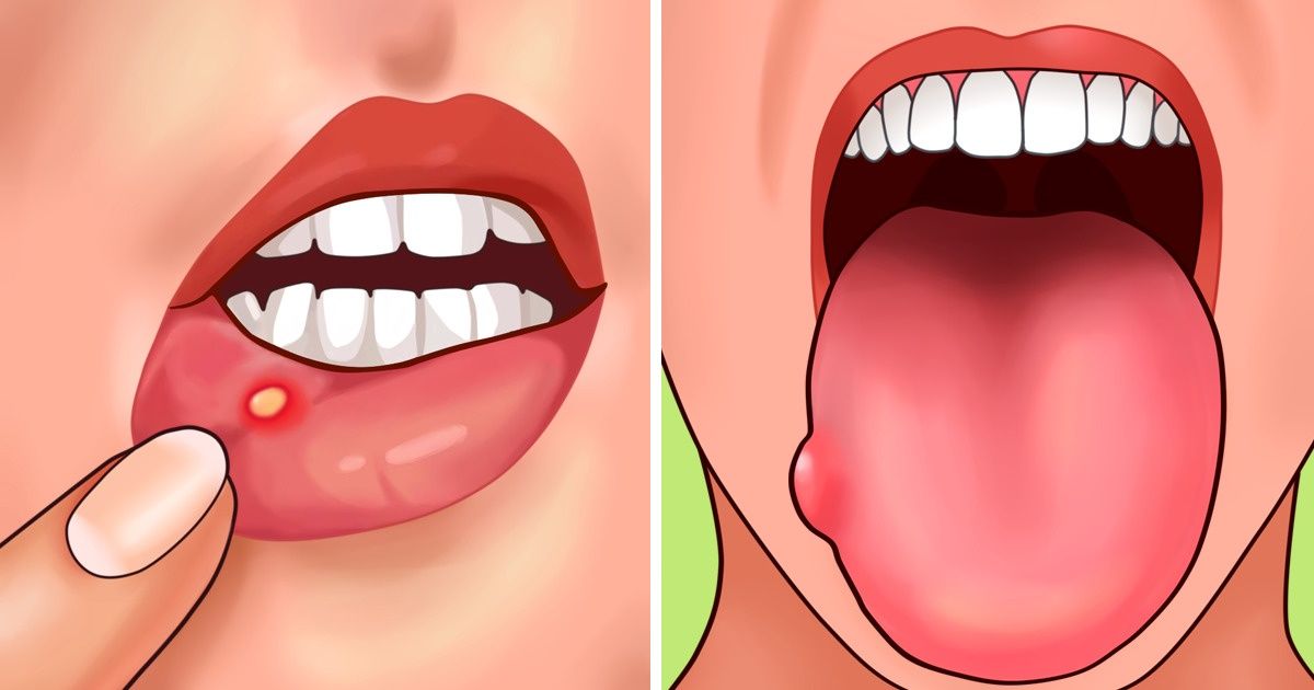 7 Signs Your Body Needs More Folic Acid