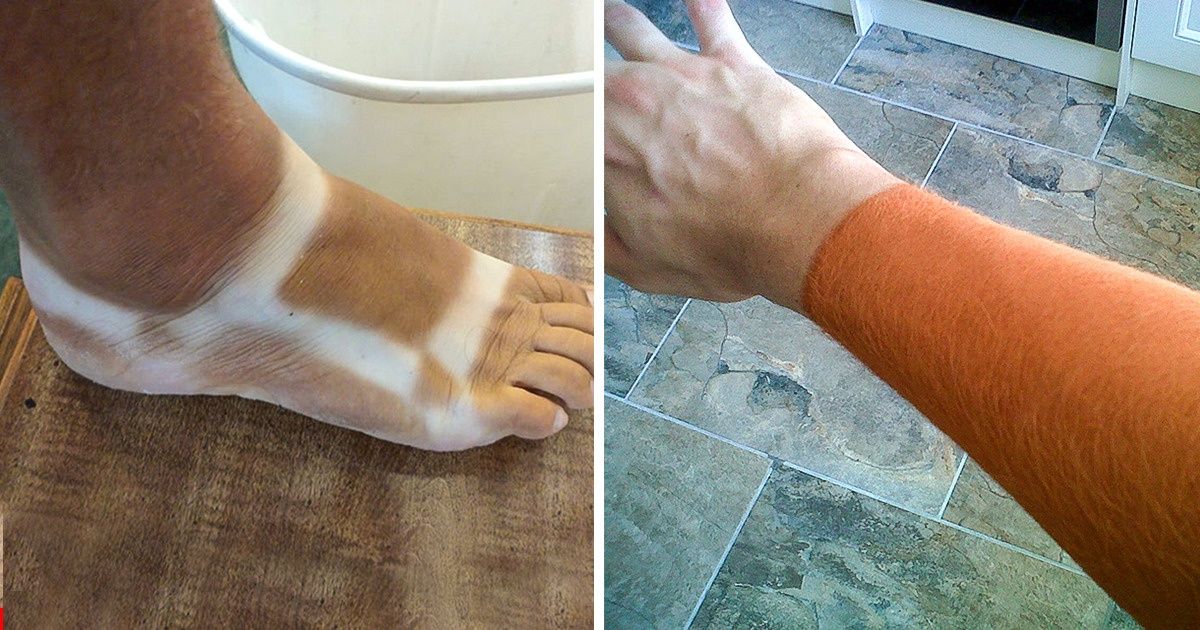 20 Pics of People Who Took Tanning Too Far and Were “Truly Marked” 20 Pics of People Who Took Tanning Too Far and Were “Truly Marked”