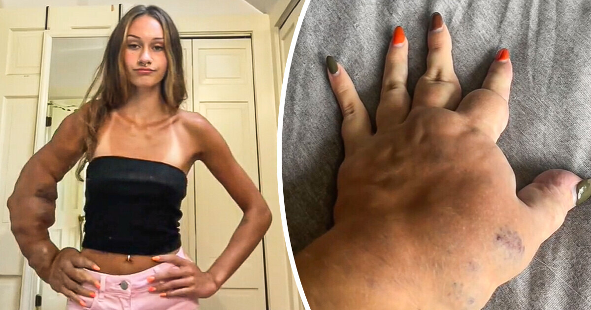 A Girl With a Rare Condition Has the Perfect Response to Online Trolls Telling Her She Should Remove Her Arm A Girl With a Rare Condition Has the Perfect Response to Online Trolls Telling Her She Should Remove Her Arm