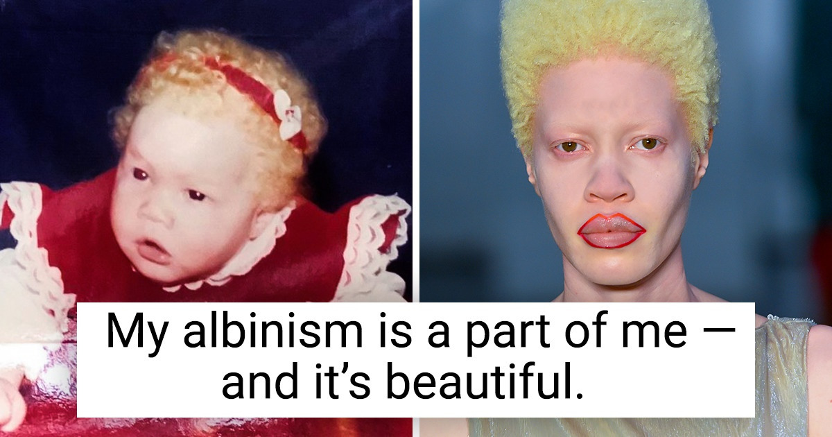 15 People Who Teach Us “It’s Okay to Be Different” 15 People Who Teach Us “It’s Okay to Be Different”