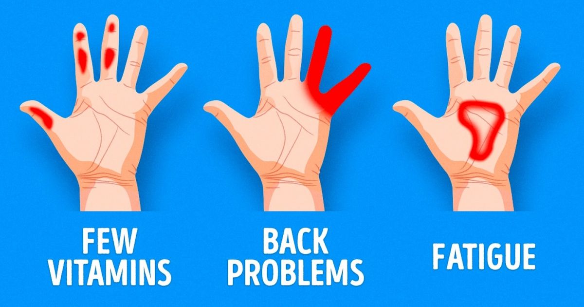 7 Important Things Your Hands Are Trying To Tell You About Your Health Bright Side