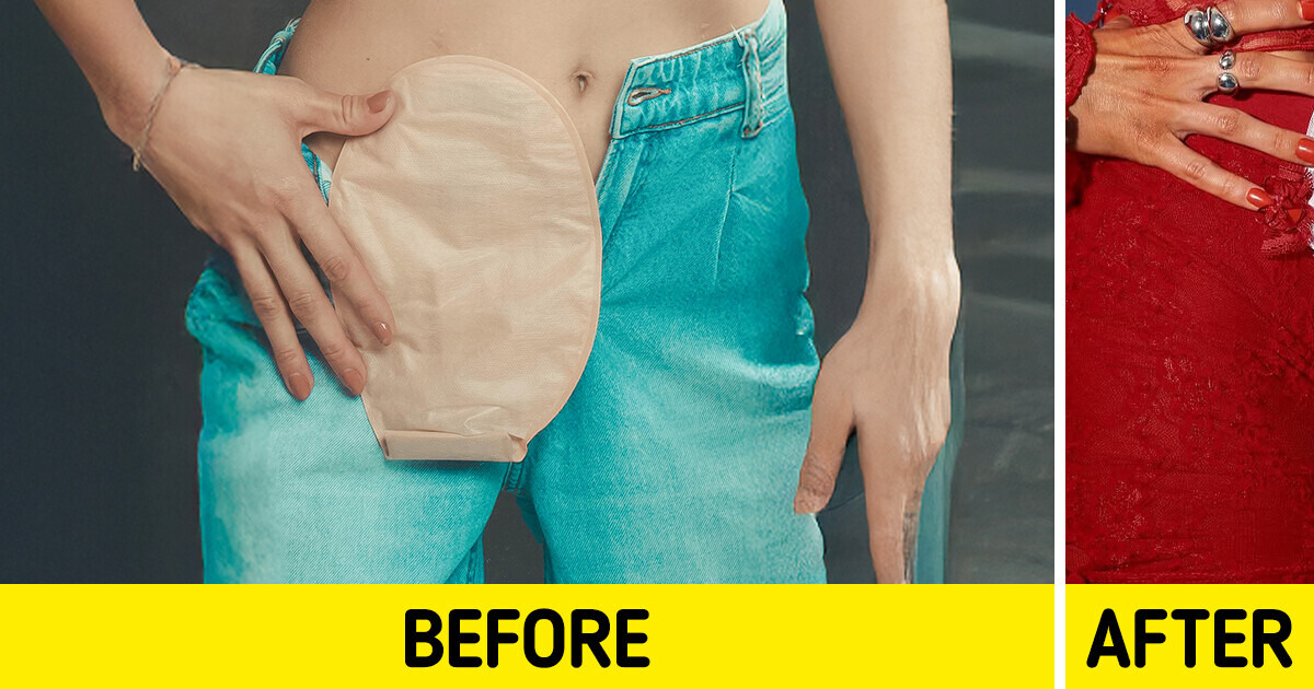 A Woman Is Turning Medical Devices Into Fashion Must-Haves, and the Result Has Everyone in Awe A Woman Is Turning Medical Devices Into Fashion Must-Haves, and the Result Has Everyone in Awe