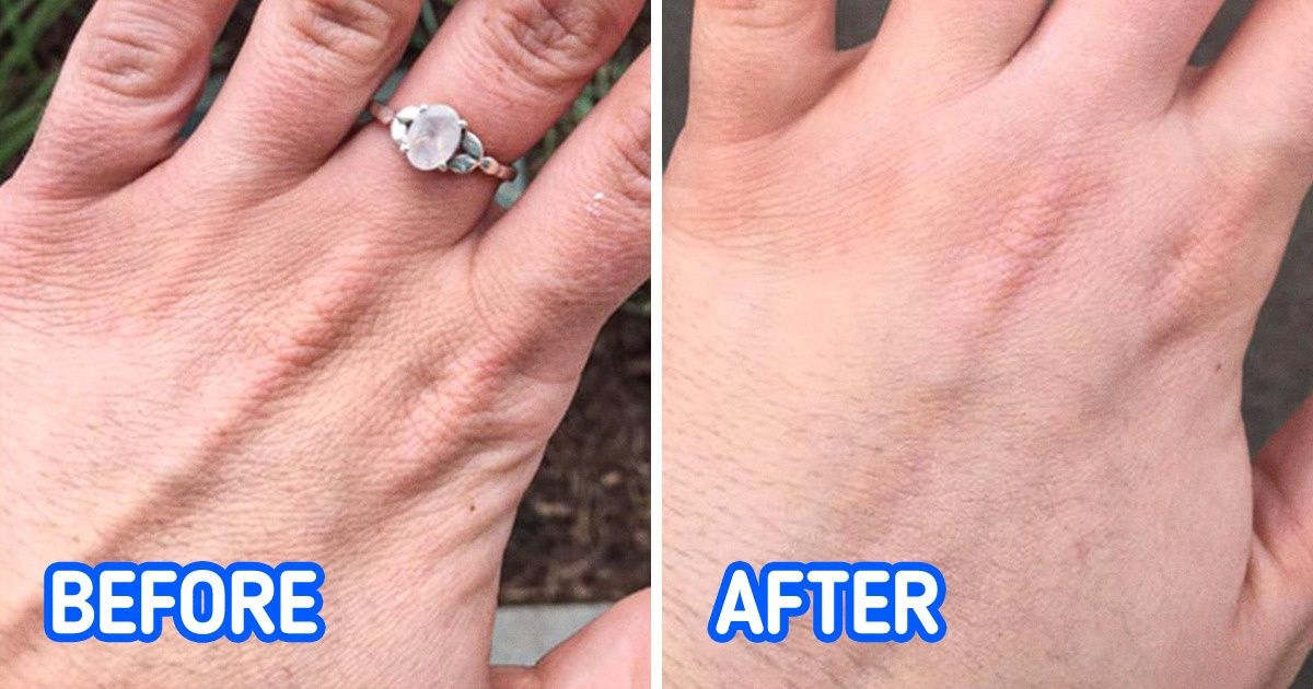 8 Tips to Make Your Hands Look Younger 8 Tips to Make Your Hands Look Younger