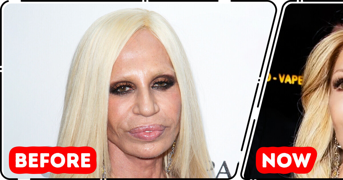 “This Is the Best She Has Looked in Decades!” New Look of Donatella Versace Creates Buzz “This Is the Best She Has Looked in Decades!” New Look of Donatella Versace Creates Buzz
