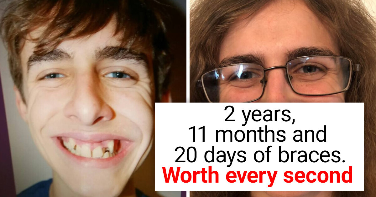 15+ Before and After Photos That Show the Power of Time 15+ Before and After Photos That Show the Power of Time