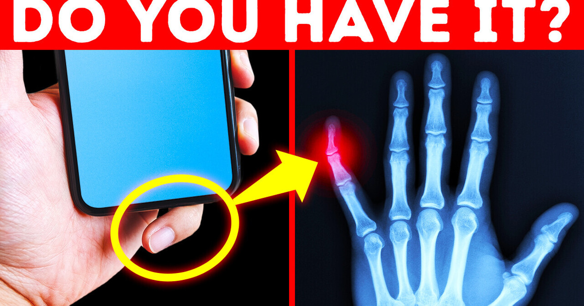 If You’ve Been Holding Your Phone This Way, Then Stop If You’ve Been Holding Your Phone This Way, Then Stop