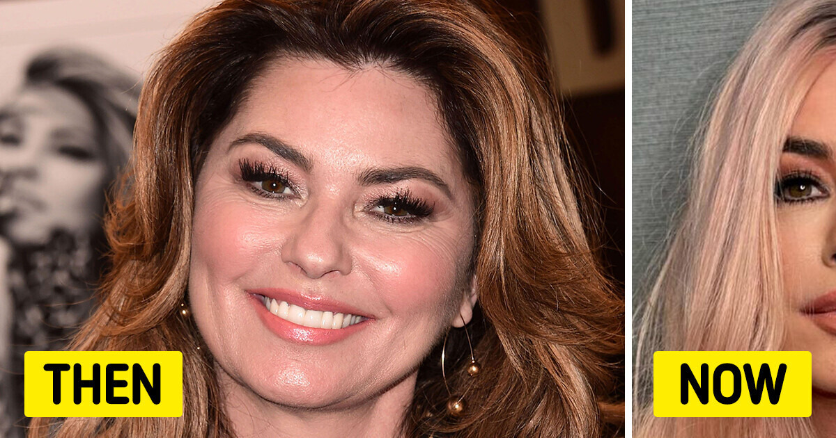 Shania Twain Deemed Unrecognizable After Her Face Shocked People in New ...