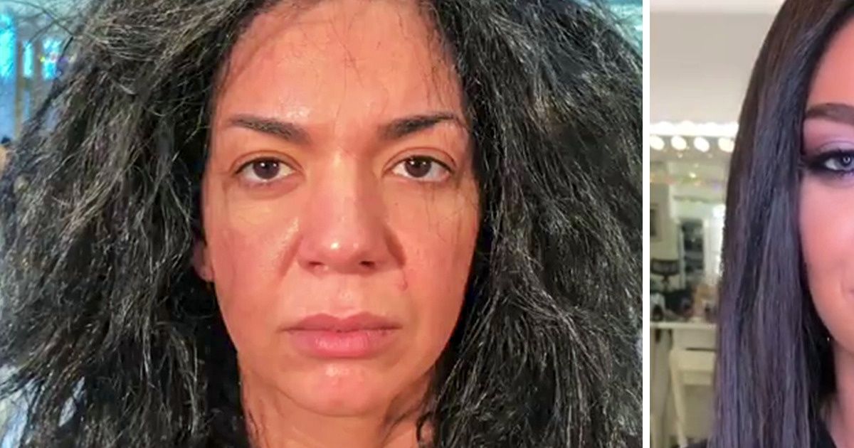 20+ Photos That Prove You Don’t Need Plastic Surgery to Look Stunning 20+ Photos That Prove You Don’t Need Plastic Surgery to Look Stunning