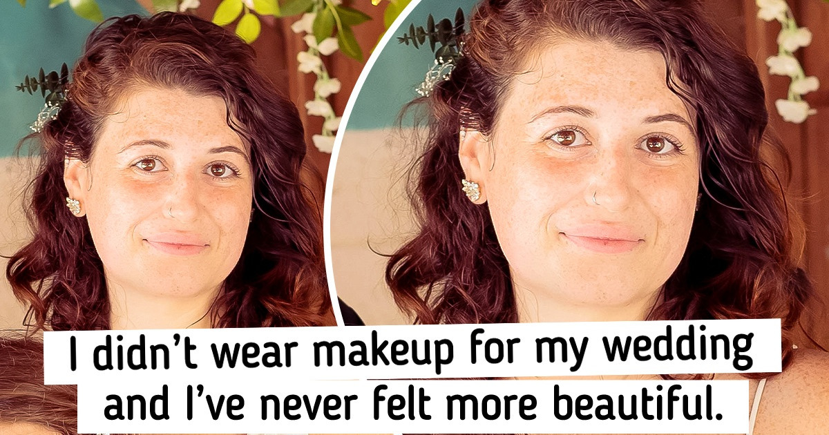 16 People Who Were Brave Enough to Embrace Their Natural Beauty