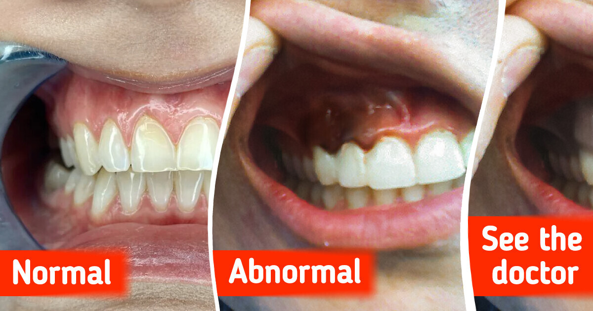 5 Warning Signs Your Gums May Be Telling You About Your Health 5 Warning Signs Your Gums May Be Telling You About Your Health