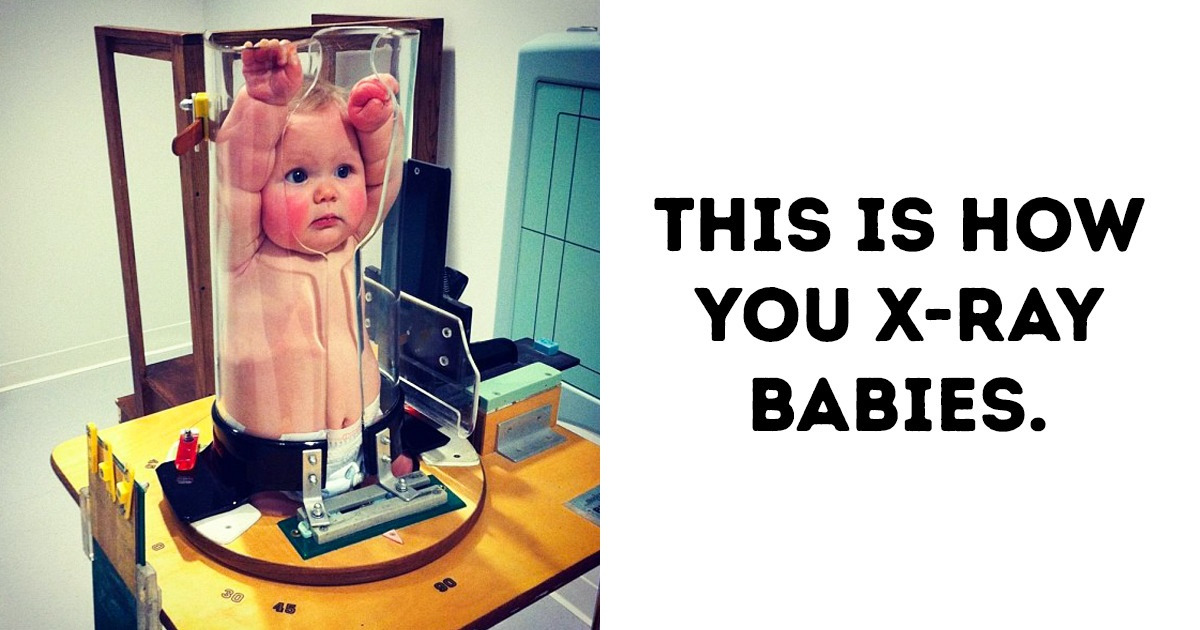 19 Crazy Situations That Prove Medicine Is a Real Puzzle