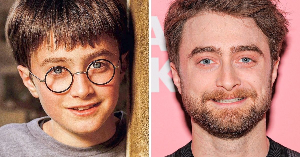 11 Celebs Who Didn’t Let Their Conditions Stand in the Way of Their Dreams 11 Celebs Who Didn’t Let Their Conditions Stand in the Way of Their Dreams
