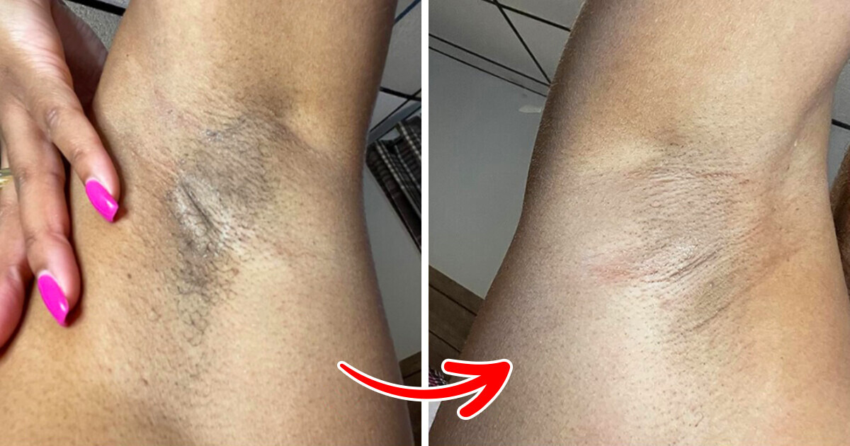 Stop Googling: These 10 Amazon Gems Will Help You Fix Your “Embarrassing” Problems Stop Googling: These 10 Amazon Gems Will Help You Fix Your “Embarrassing” Problems