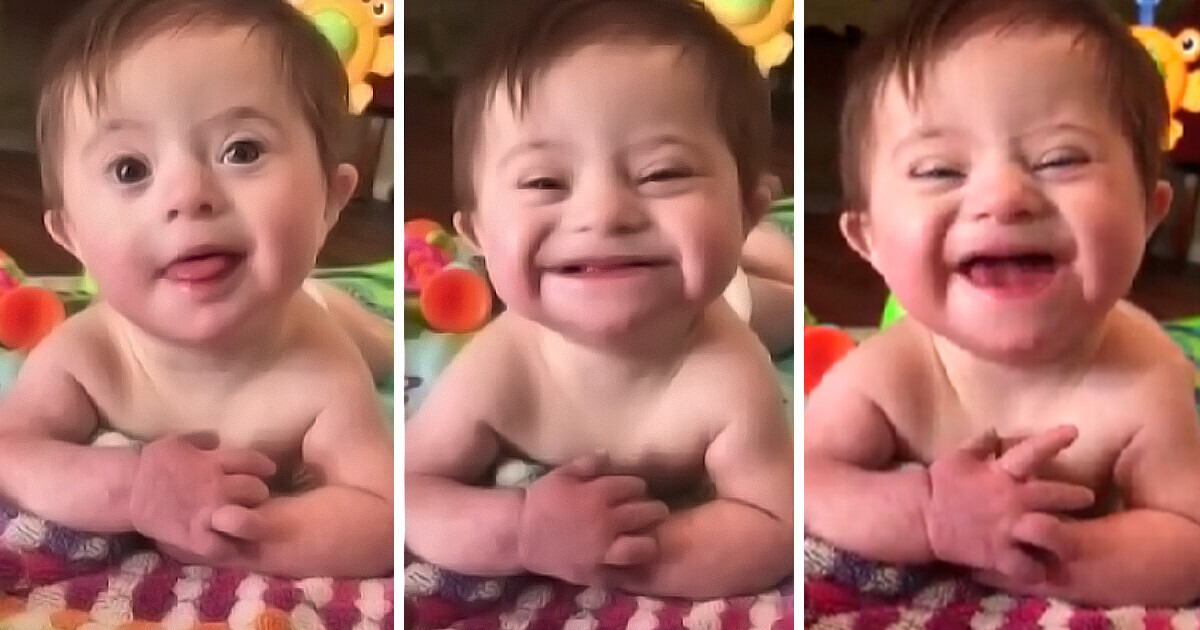 A Baby With Down Syndrome Gives Mom Her First Smile and Captures Millions of Hearts in a Viral Video / Bright Side