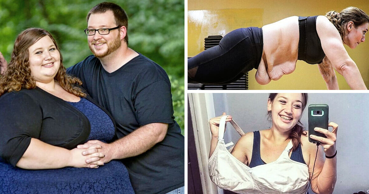 Couple Pledged to Lose Weight, And Their Extreme Result Stunned ...