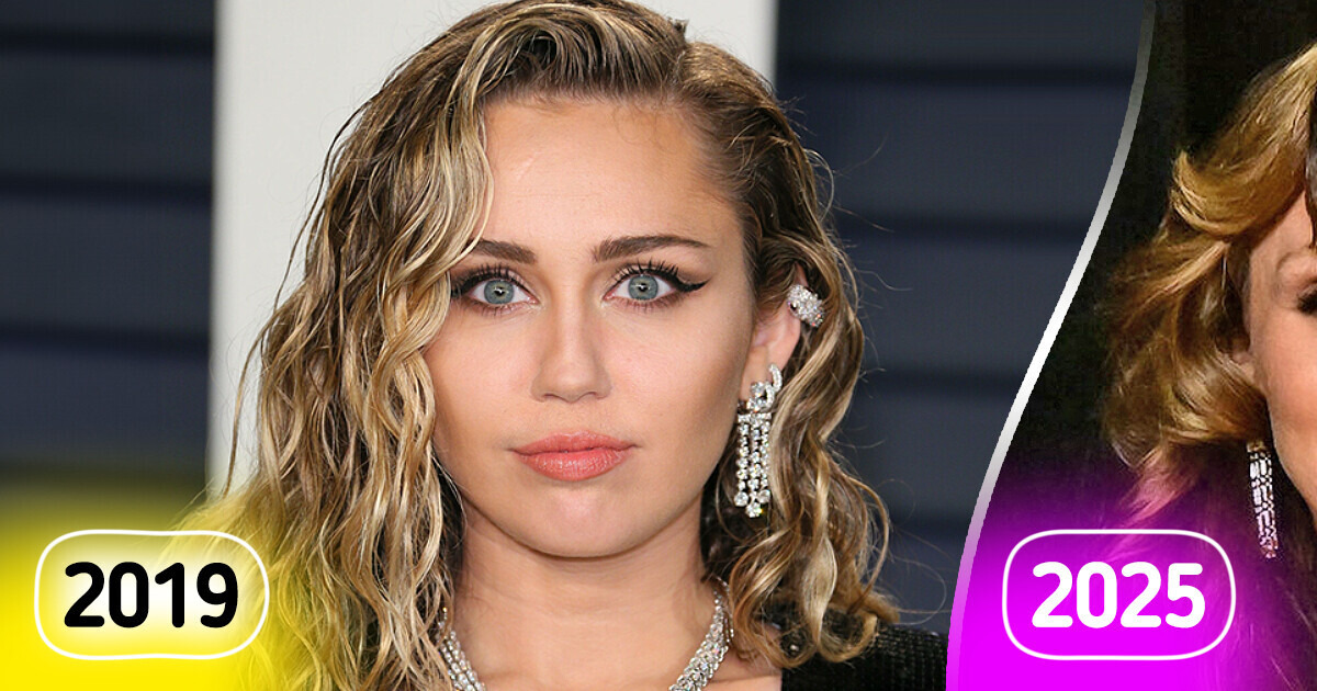 Miley Cyrus Shocks Fans With Bold Look at Oscars 2025, See Her Drastic Transformation Miley Cyrus Shocks Fans With Bold Look at Oscars 2025, See Her Drastic Transformation
