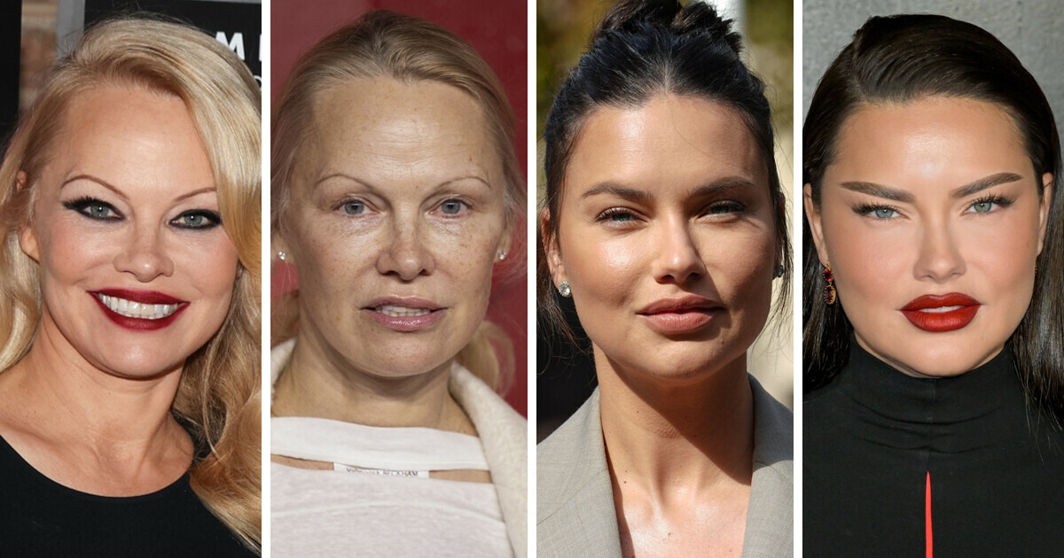 10 Celebrities Who Suddenly Altered Their Looks