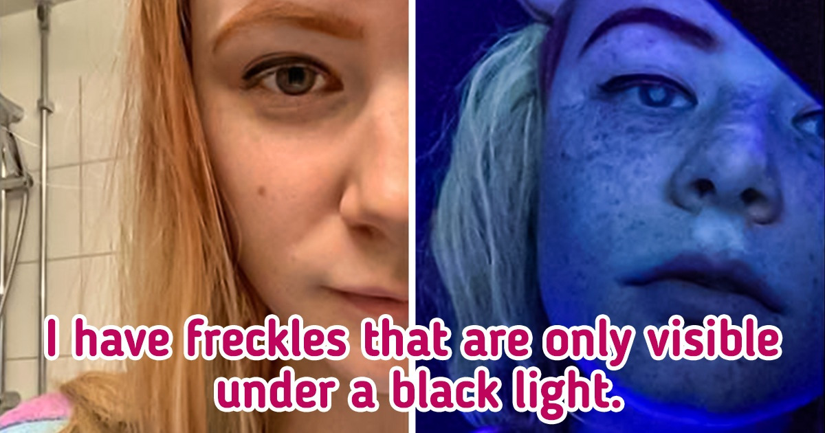8 Things Your Body Might Be Hiding From You 8 Things Your Body Might Be Hiding From You