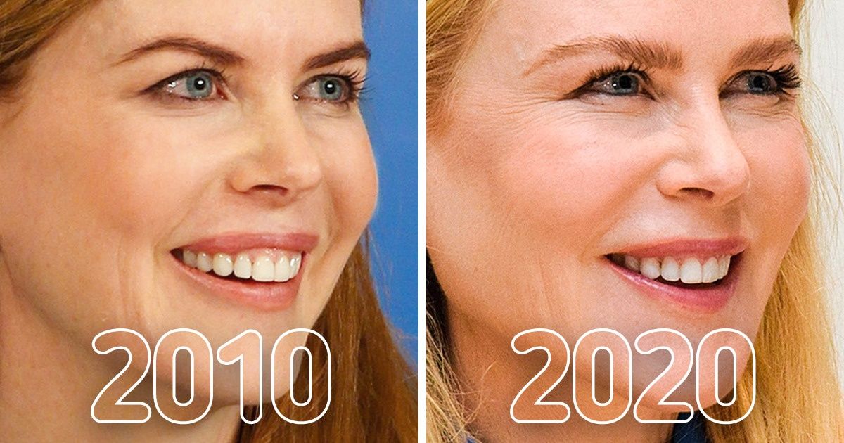 20+ Photos That Clearly Show How Celebrities Have Changed in the Past 10 Years