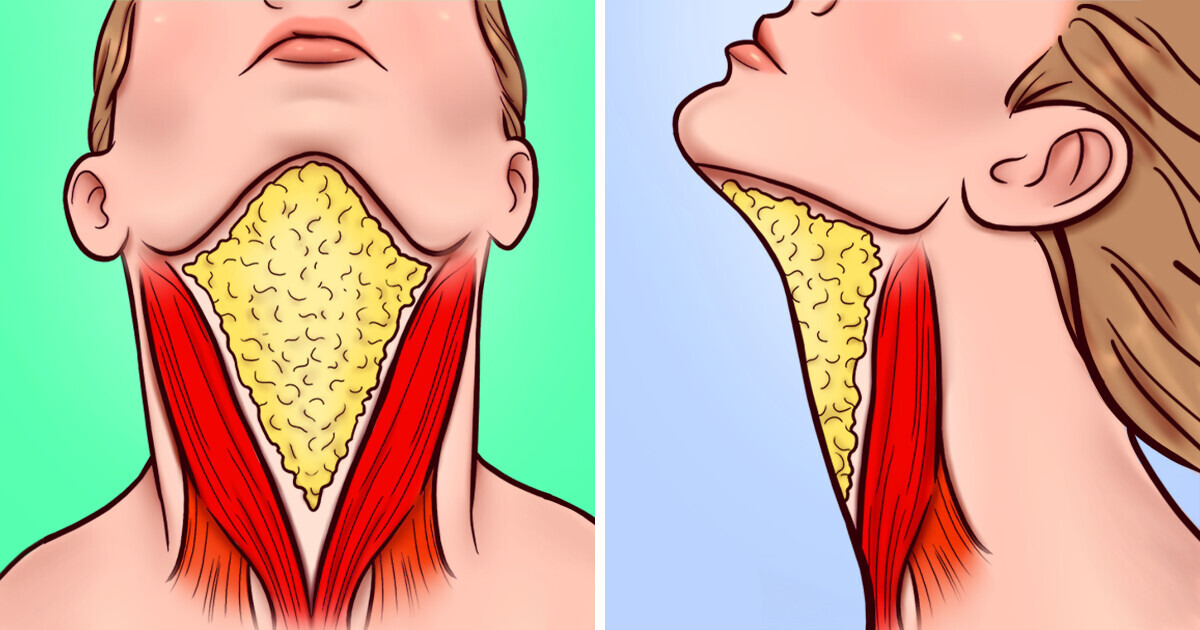 What Might Cause a Double Chin and 4 Ways to Get Rid of It What Might Cause a Double Chin and 4 Ways to Get Rid of It