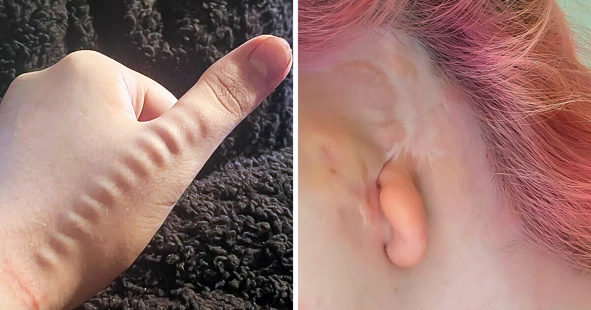 15 Unusual Body Traits We Weren’t Prepared to See Today 15 Unusual Body Traits We Weren’t Prepared to See Today