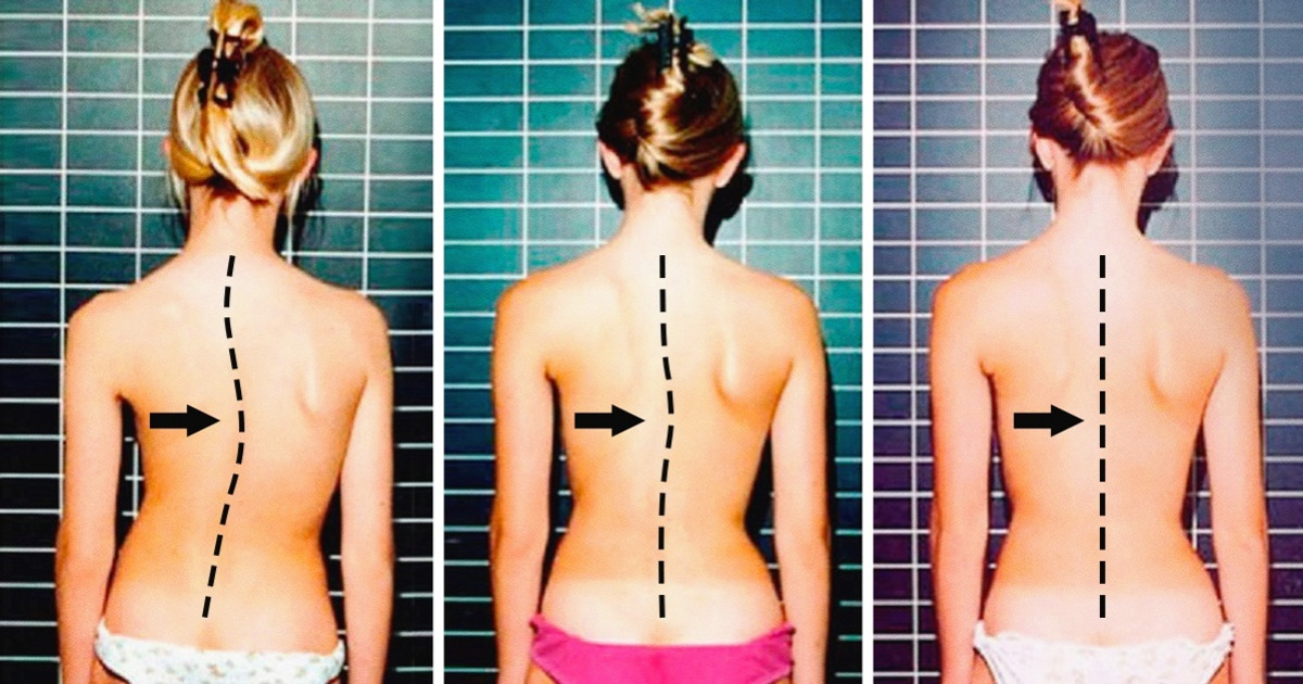 Five fantastic exercises to give you a healthy spine