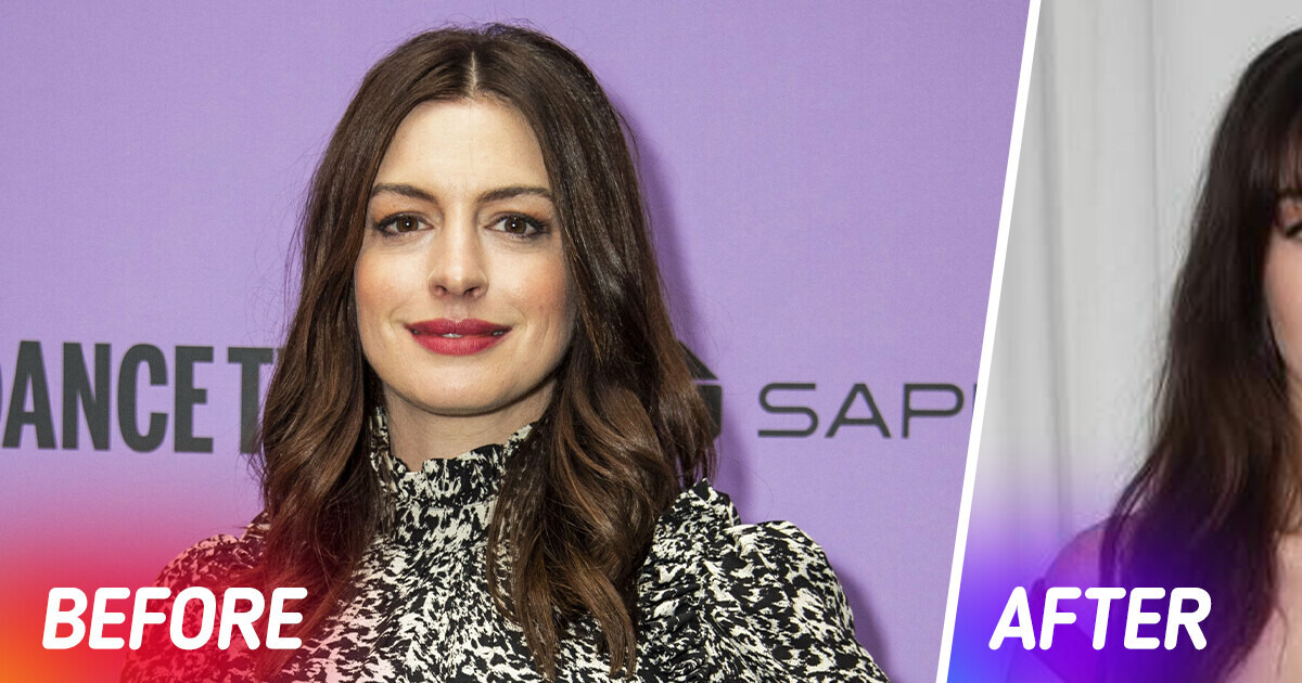 Anne Hathaway Deemed Unrecognizable After Her Face Shocked Many in New Pics Anne Hathaway Deemed Unrecognizable After Her Face Shocked Many in New Pics