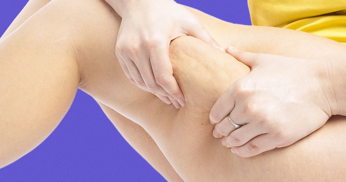 7 Foods That May Help You Fight Cellulite 7 Foods That May Help You Fight Cellulite