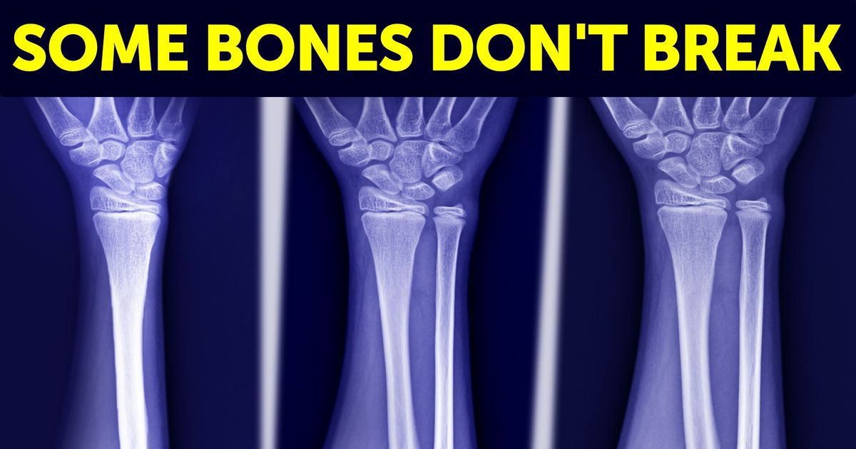 7 Body Features That Sound Supernatural, yet Are Present in Some of Us