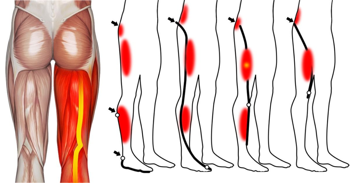 Simple Exercises That Relieve Leg Pain in the Blink of an Eye