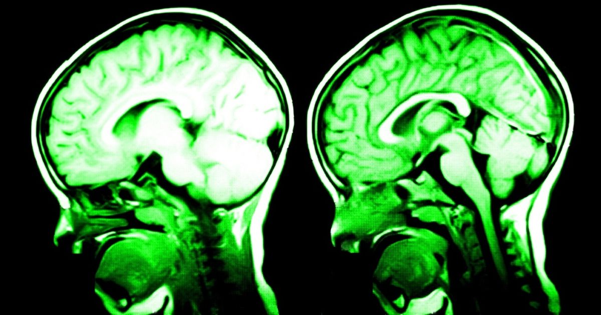 7 Things That Physically Change Your Brain