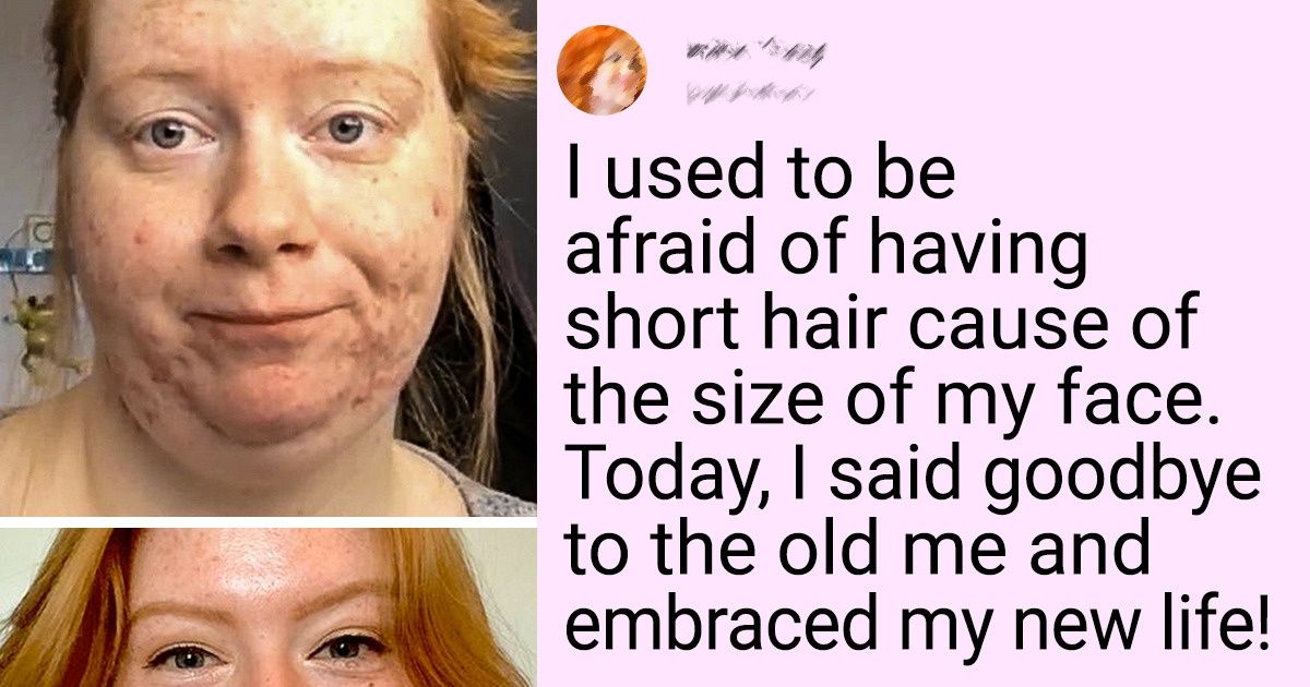 13 People Who Accepted Their Imperfections and Started to Live a Full Life 13 People Who Accepted Their Imperfections and Started to Live a Full Life