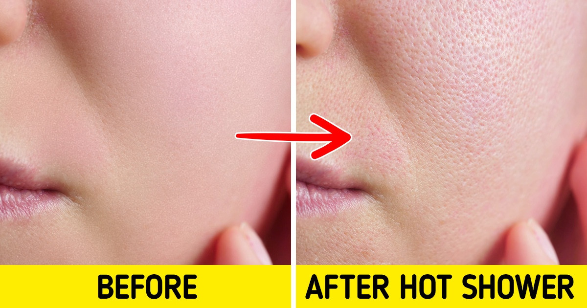 8 Skincare Tips You Might’ve Tried, That May Be Bad for You