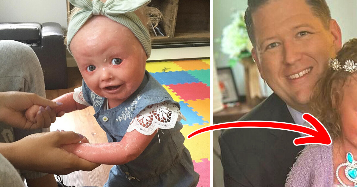 Parents Left Stunned by Newborn’s Appearance — Now at 6, She’s Their Little “Beauty Queen” Parents Left Stunned by Newborn’s Appearance — Now at 6, She’s Their Little “Beauty Queen”