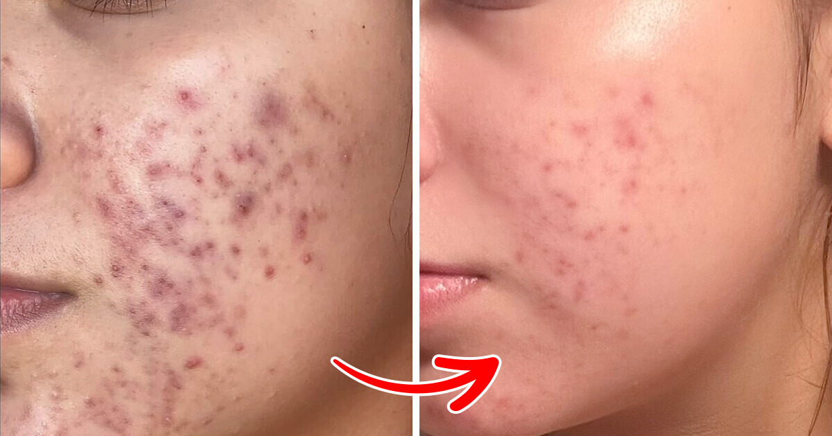 10 skincare products from Amazon that are real game changers 10 skincare products from Amazon that are real game changers