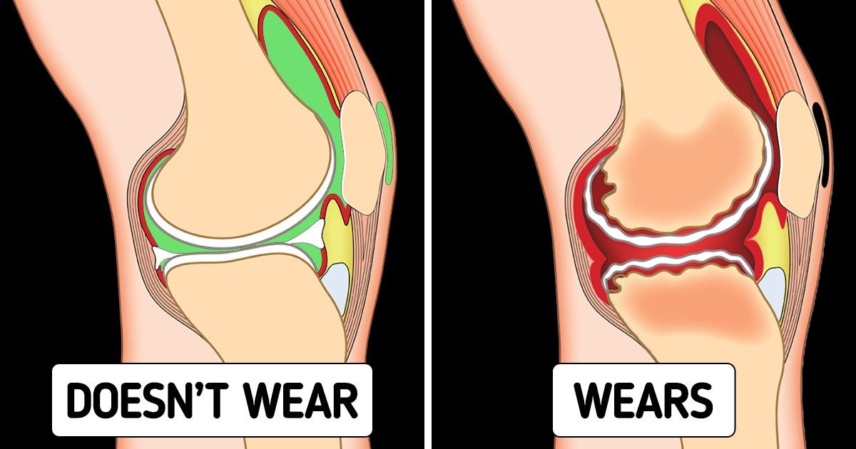 What Can Happen to Your Body If You Wear High Heels Every Day What Can Happen to Your Body If You Wear High Heels Every Day