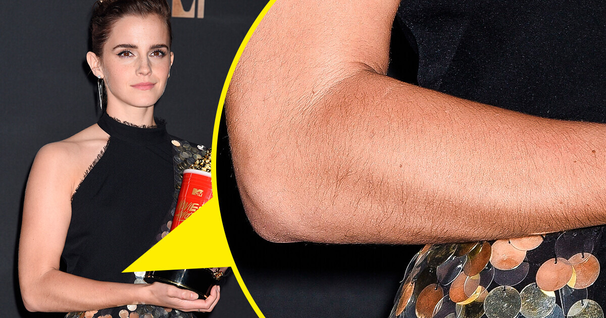 A Woman Shared That Her Boyfriend Doesn’t Like Female Body Hair, and Here’s How People Responded A Woman Shared That Her Boyfriend Doesn’t Like Female Body Hair, and Here’s How People Responded