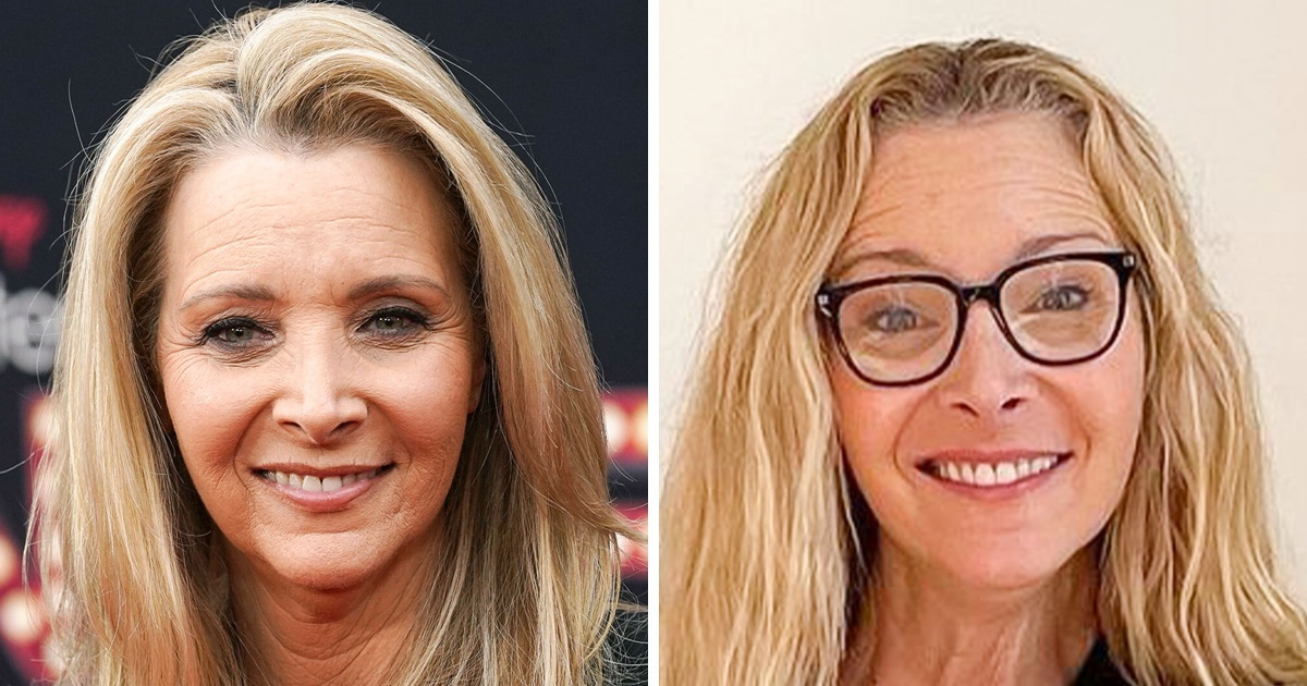 15 Celebrities Who Are Not Afraid to Show Their Photos Without Makeup