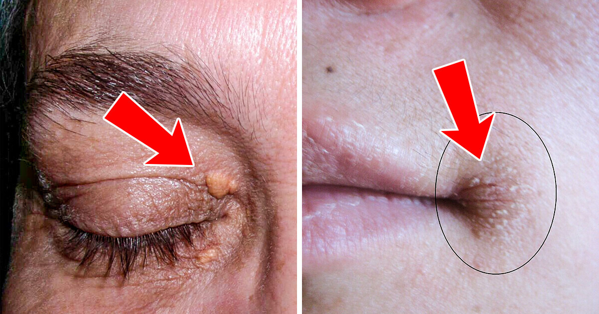 4 Subtle Signs on Your Face That Could Signal Health Problems 4 Subtle Signs on Your Face That Could Signal Health Problems