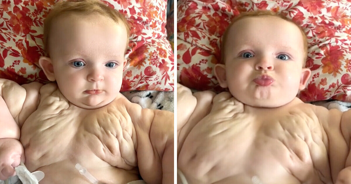 Doctors Told Me My Baby Had a “Zero Percent” Chance of Survival, but She Defied the Odds