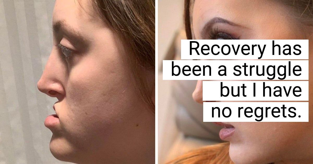 20 People That Got Plastic Surgery and Are Rocking Their New Looks 20 People That Got Plastic Surgery and Are Rocking Their New Looks