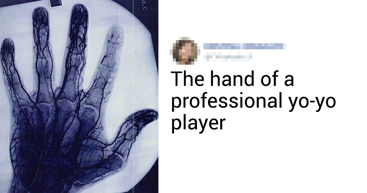 20+ Photos You Probably Won’t Find Even in the Hugest Encyclopedias 20+ Photos You Probably Won’t Find Even in the Hugest Encyclopedias