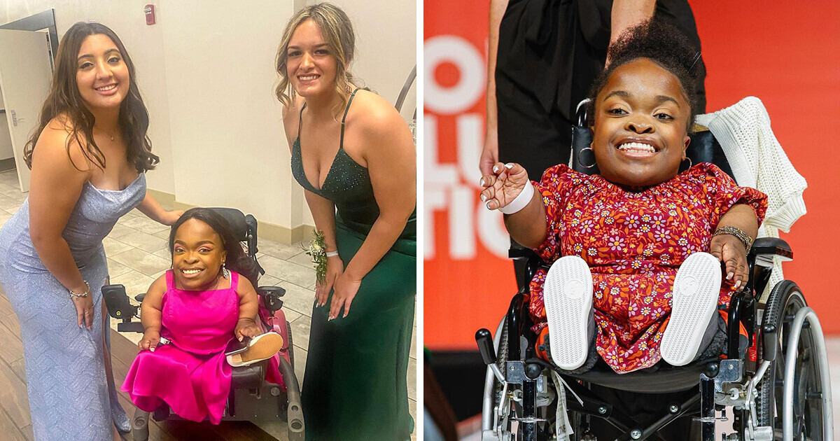 World’s Shortest Model Wants to Prove Nothing Can Come Between You and Your Dreams