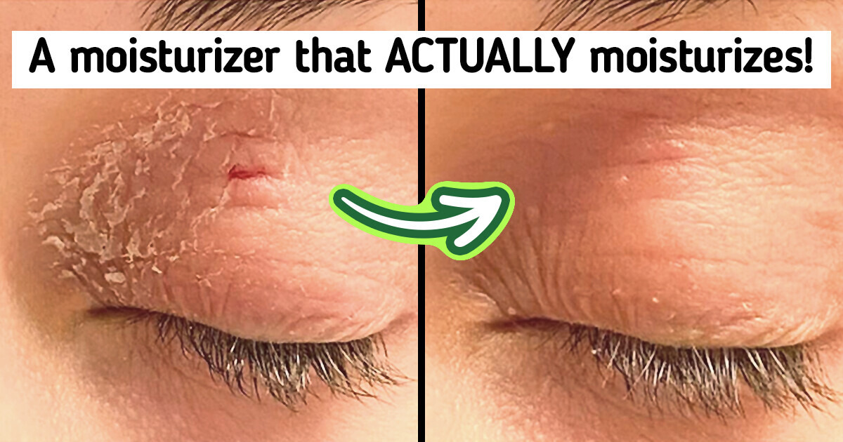 Bring Your Dry Skin to Life With These Top 10 Best-Selling Products Bring Your Dry Skin to Life With These Top 10 Best-Selling Products