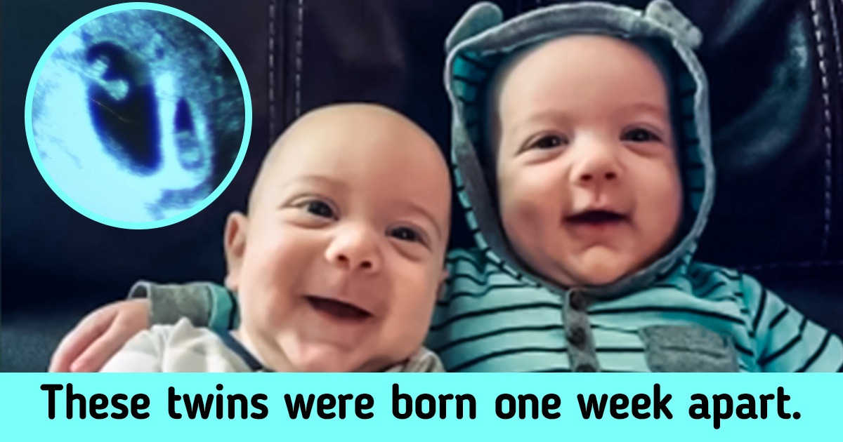 I Got Pregnant and a Week Later I Was Already Expecting Another Baby I Got Pregnant and a Week Later I Was Already Expecting Another Baby