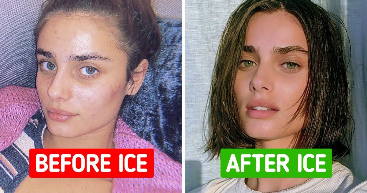 6 Natural Ways to Get Rid of Pimples and Make Your Skin Happy 6 Natural Ways to Get Rid of Pimples and Make Your Skin Happy
