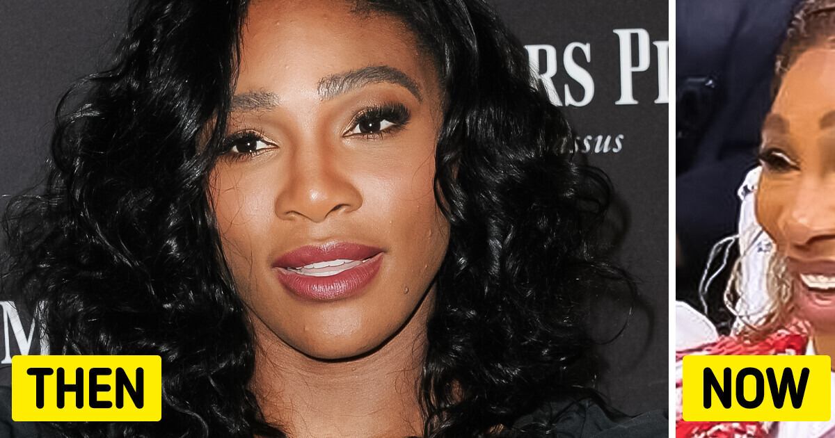 “Stop with the Botox” People React as Serena Williams’ Latest Appearance Sparks Concern “Stop with the Botox” People React as Serena Williams’ Latest Appearance Sparks Concern