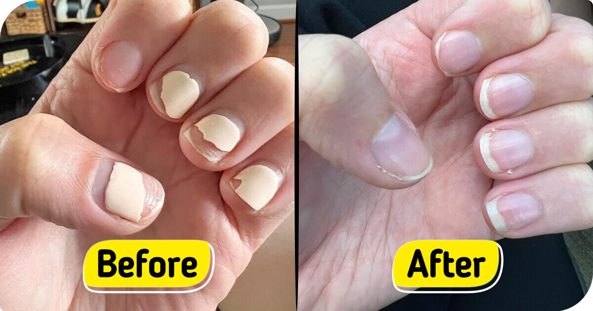 11 Beauty Products That Fix Many Issues You Might Be Facing 11 Beauty Products That Fix Many Issues You Might Be Facing