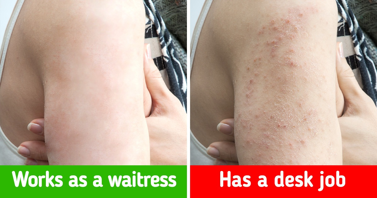 What Could Happen to Your Body If You Sit Too Much